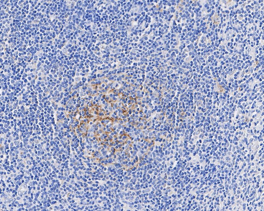 Immunohistochemical analysis of paraffin-embedded human tonsil tissue with Mouse anti-CD35 antibody (HA601023) at 1/500 dilution.<br />
<br />
The section was pre-treated using heat mediated antigen retrieval with Tris-EDTA buffer (pH 9.0) for 20 minutes. The tissues were blocked in 1% BSA for 20 minutes at room temperature, washed with ddH2O and PBS, and then probed with the primary antibody (HA601023) at 1/500 dilution for 1 hour at room temperature. The detection was performed using an HRP conjugated compact polymer system. DAB was used as the chromogen. Tissues were counterstained with hematoxylin and mounted with DPX.