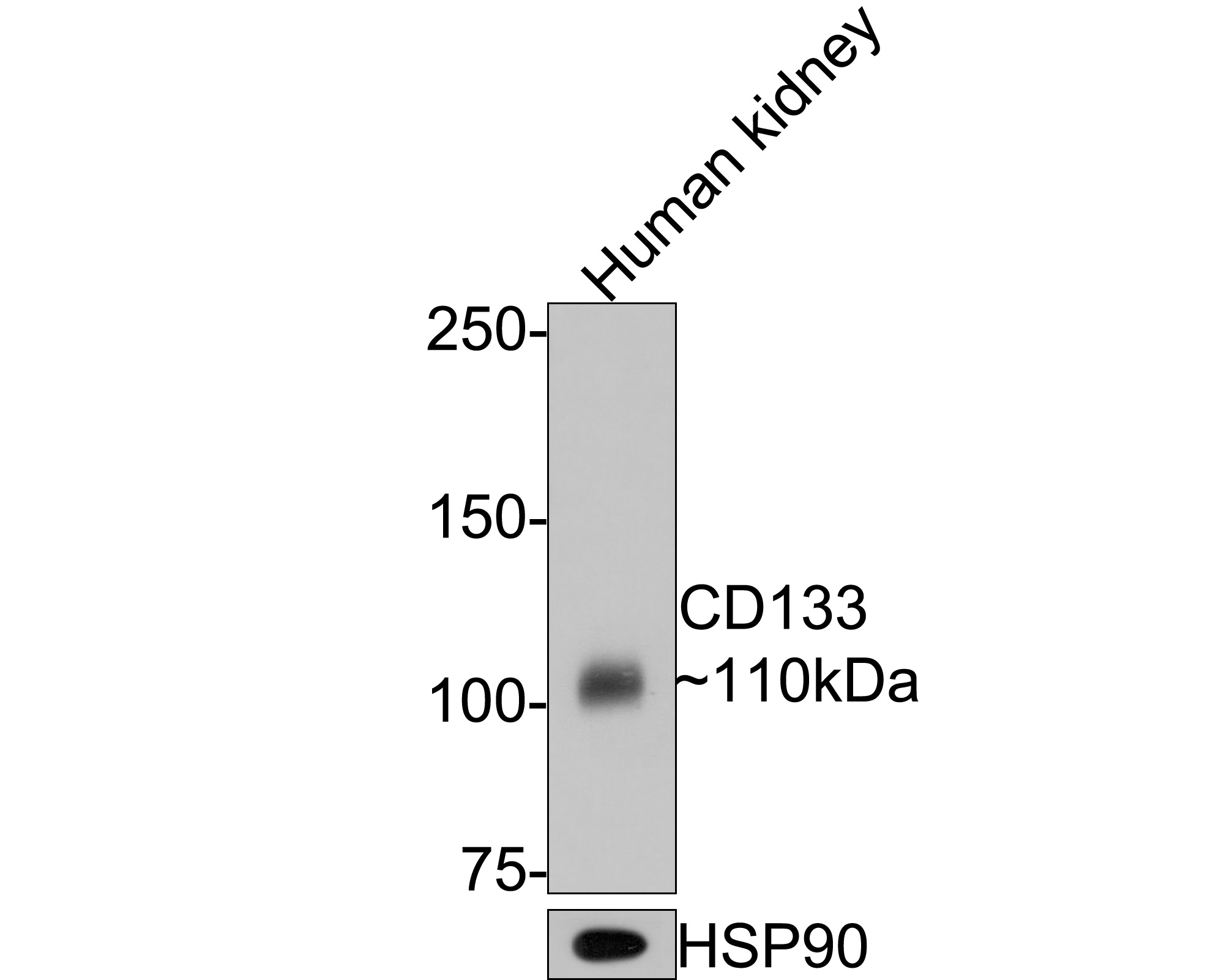 Western blot analysis of CD133 on human kidney tissue lysates with Mouse anti-CD133 antibody (HA601024) at 1/500 dilution.<br />
<br />
Lysates/proteins at 20 µg/Lane.<br />
<br />
Predicted band size: 97 kDa<br />
Observed band size: 110 kDa<br />
<br />
Exposure time: 30 seconds;<br />
<br />
6% SDS-PAGE gel.<br />
<br />
Proteins were transferred to a PVDF membrane and blocked with 5% NFDM/TBST for 1 hour at room temperature. The primary antibody (HA601024) at 1/500 dilution was used in 5% NFDM/TBST at room temperature for 2 hours. Goat Anti-Mouse IgG - HRP Secondary Antibody (HA1006) at 1:100,000 dilution was used for 1 hour at room temperature.
