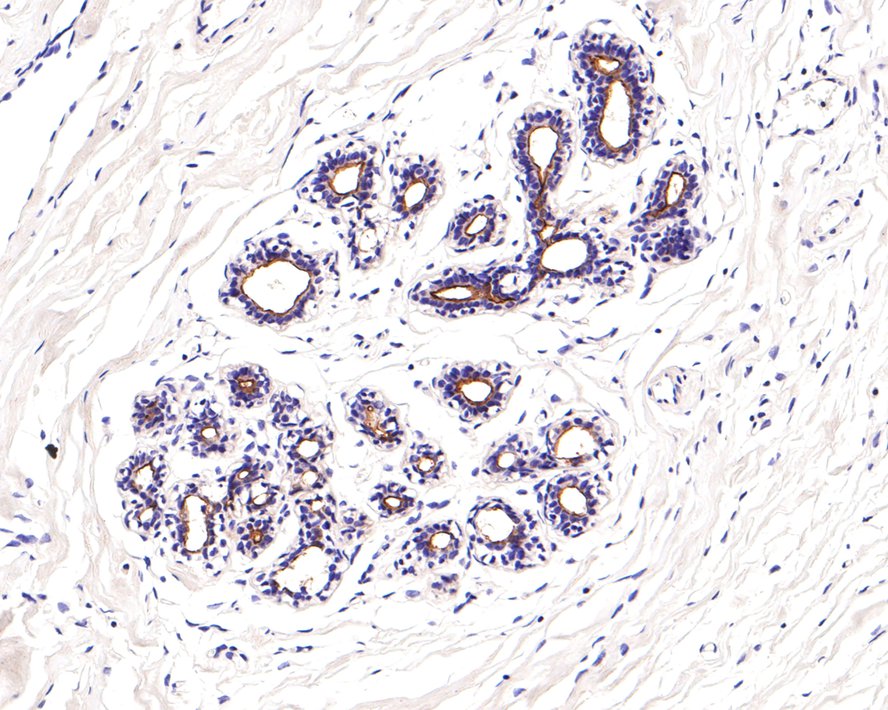 Immunohistochemical analysis of paraffin-embedded human breast tissue with Mouse anti-CD133 antibody (HA601025) at 1/600 dilution.<br />
<br />
The section was pre-treated using heat mediated antigen retrieval with Tris-EDTA buffer (pH 9.0) for 20 minutes. The tissues were blocked in 1% BSA for 20 minutes at room temperature, washed with ddH2O and PBS, and then probed with the primary antibody (HA601025) at 1/600 dilution for 1 hour at room temperature. The detection was performed using an HRP conjugated compact polymer system. DAB was used as the chromogen. Tissues were counterstained with hematoxylin and mounted with DPX.