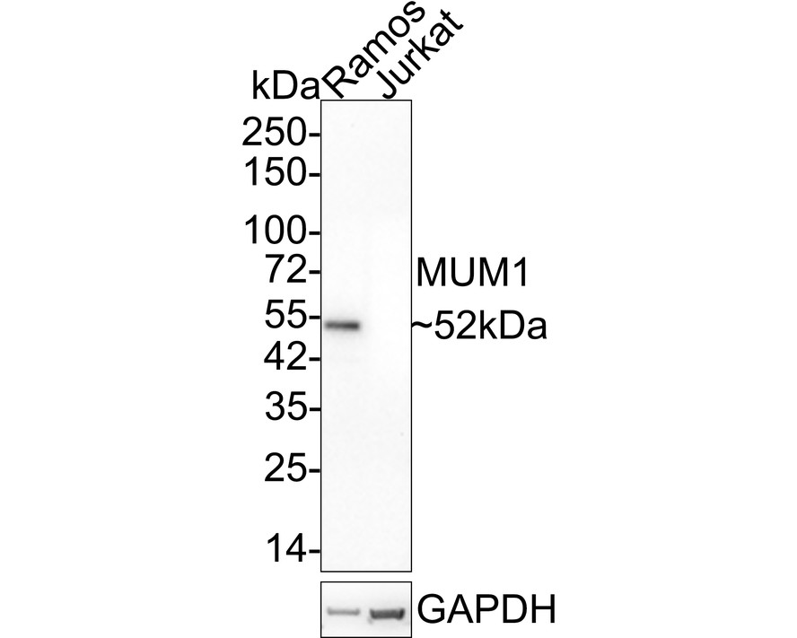 Immunohistochemical analysis of paraffin-embedded human colon tissue with Mouse anti-MUM1 antibody (HA601030) at 1/1,500 dilution.<br />
<br />
The section was pre-treated using heat mediated antigen retrieval with sodium citrate buffer (pH 6.0) for 2 minutes. The tissues were blocked in 1% BSA for 20 minutes at room temperature, washed with ddH2O and PBS, and then probed with the primary antibody (HA601030) at 1/1,500 dilution for 1 hour at room temperature. The detection was performed using an HRP conjugated compact polymer system. DAB was used as the chromogen. Tissues were counterstained with hematoxylin and mounted with DPX.