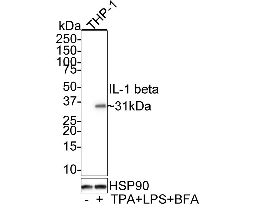 Western blot analysis of IL-1 beta on different lysates with Mouse anti-IL-1 beta antibody (HA601035) at 1/500 dilution.<br />
<br />
Lane 1: THP-1 cell lysate<br />
Lane 2: THP-1 treated with LPS cell lysate<br />
<br />
Lysates/proteins at 10 µg/Lane.<br />
<br />
Predicted band size: 31 kDa<br />
Observed band size: 36 kDa<br />
<br />
Exposure time: 2 minutes;<br />
<br />
12% SDS-PAGE gel.<br />
<br />
Proteins were transferred to a PVDF membrane and blocked with 5% NFDM/TBST for 1 hour at room temperature. The primary antibody (HA601035) at 1/500 dilution was used in 5% NFDM/TBST at room temperature for 2 hours. Goat Anti-Mouse IgG - HRP Secondary Antibody (HA1006) at 1:100,000 dilution was used for 1 hour at room temperature.