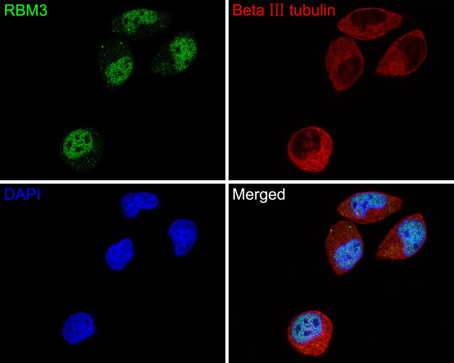 Immunocytochemistry analysis of Hela cells labeling RBM3 with Rabbit anti-RBM3 antibody (HA721130) at 1/50 dilution.<br />
<br />
Cells were fixed in 4% paraformaldehyde for 10 minutes at 37 ℃, permeabilized with 0.05% Triton X-100 in PBS for 20 minutes, and then blocked with 2% negative goat serum for 30 minutes at room temperature. Cells were then incubated with Rabbit anti-RBM3 antibody (HA721130) at 1/50 dilution in 2% negative goat serum overnight at 4 ℃. Goat Anti-Rabbit IgG H&L (Alexa Fluor® 488) was used as the secondary antibody at 1/1,000 dilution. Nuclear DNA was labelled in blue with DAPI.<br />
<br />
Beta Ⅲ tubulin (M0805-8, red) was stained at 1/200 dilution overnight at +4℃. Goat Anti-Mouse IgG H&L (Alexa Fluor® 647) were used as the secondary antibody at 1/1,000 dilution.