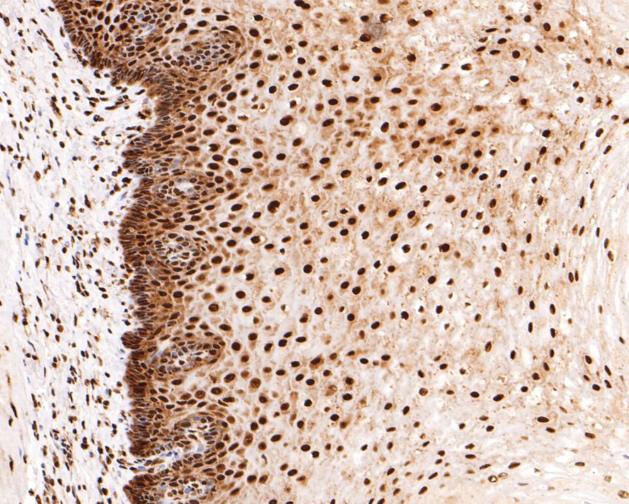 Immunohistochemical analysis of paraffin-embedded human esophagus tissue with Rabbit anti-RBM3 antibody (HA721130) at 1/400 dilution.<br />
<br />
The section was pre-treated using heat mediated antigen retrieval with sodium citrate buffer (pH 6.0) for 2 minutes. The tissues were blocked in 1% BSA for 20 minutes at room temperature, washed with ddH2O and PBS, and then probed with the primary antibody (HA721130) at 1/400 dilution for 1 hour at room temperature. The detection was performed using an HRP conjugated compact polymer system. DAB was used as the chromogen. Tissues were counterstained with hematoxylin and mounted with DPX.