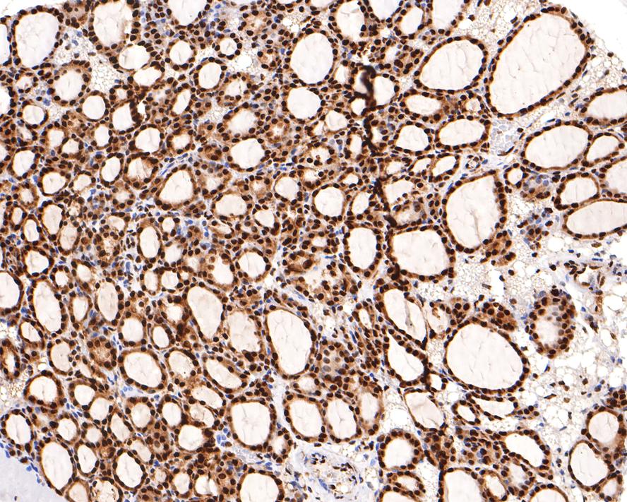 Immunohistochemical analysis of paraffin-embedded mouse thyroid tissue with Rabbit anti-RBM3 antibody (HA721130) at 1/400 dilution.<br />
<br />
The section was pre-treated using heat mediated antigen retrieval with sodium citrate buffer (pH 6.0) for 2 minutes. The tissues were blocked in 1% BSA for 20 minutes at room temperature, washed with ddH2O and PBS, and then probed with the primary antibody (HA721130) at 1/400 dilution for 1 hour at room temperature. The detection was performed using an HRP conjugated compact polymer system. DAB was used as the chromogen. Tissues were counterstained with hematoxylin and mounted with DPX.