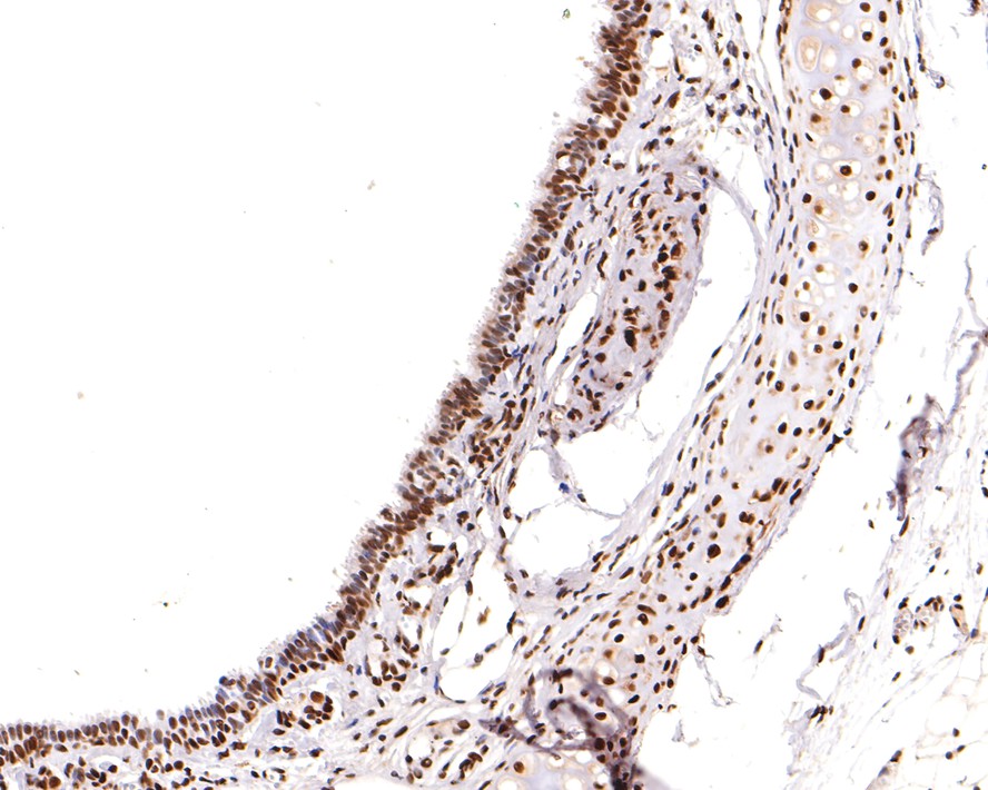 Immunohistochemical analysis of paraffin-embedded rat trachea tissue with Rabbit anti-RBM3 antibody (HA721130) at 1/400 dilution.<br />
<br />
The section was pre-treated using heat mediated antigen retrieval with sodium citrate buffer (pH 6.0) for 2 minutes. The tissues were blocked in 1% BSA for 20 minutes at room temperature, washed with ddH2O and PBS, and then probed with the primary antibody (HA721130) at 1/400 dilution for 1 hour at room temperature. The detection was performed using an HRP conjugated compact polymer system. DAB was used as the chromogen. Tissues were counterstained with hematoxylin and mounted with DPX.