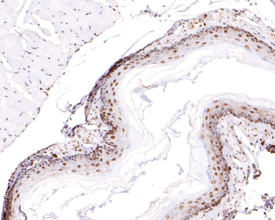 Immunohistochemical analysis of paraffin-embedded rat esophagus tissue with Rabbit anti-RBM3 antibody (HA721130) at 1/400 dilution.<br />
<br />
The section was pre-treated using heat mediated antigen retrieval with sodium citrate buffer (pH 6.0) for 2 minutes. The tissues were blocked in 1% BSA for 20 minutes at room temperature, washed with ddH2O and PBS, and then probed with the primary antibody (HA721130) at 1/400 dilution for 1 hour at room temperature. The detection was performed using an HRP conjugated compact polymer system. DAB was used as the chromogen. Tissues were counterstained with hematoxylin and mounted with DPX.