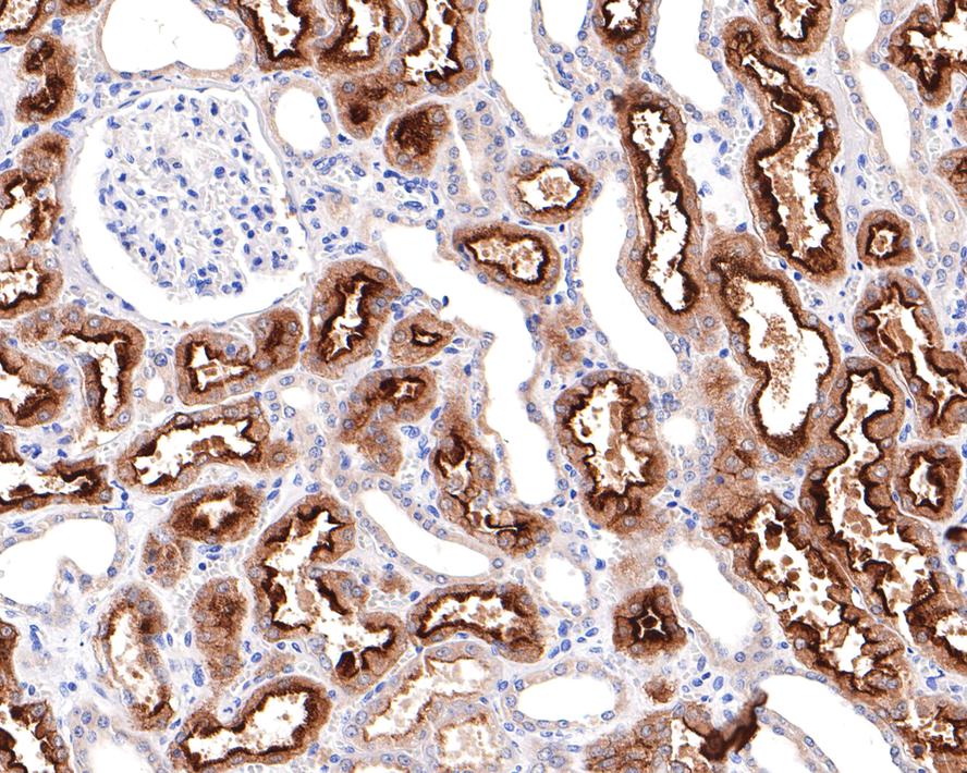 Immunohistochemical analysis of paraffin-embedded human kidney tissue with Rabbit anti-Villin1 antibody (HA721134) at 1/3,000 dilution.<br />
<br />
The section was pre-treated using heat mediated antigen retrieval with Tris-EDTA buffer (pH 9.0) for 20 minutes. The tissues were blocked in 1% BSA for 20 minutes at room temperature, washed with ddH2O and PBS, and then probed with the primary antibody (HA721134) at 1/3,000 dilution for 1 hour at room temperature. The detection was performed using an HRP conjugated compact polymer system. DAB was used as the chromogen. Tissues were counterstained with hematoxylin and mounted with DPX.