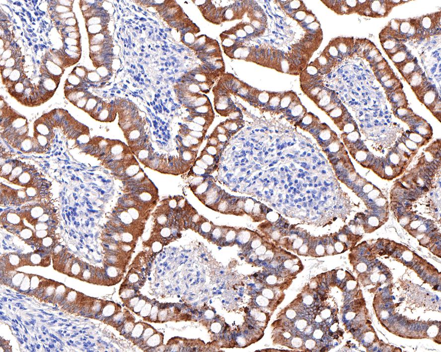 Immunohistochemical analysis of paraffin-embedded human small intestine tissue with Rabbit anti-Villin1 antibody (HA721134) at 1/3,000 dilution.<br />
<br />
The section was pre-treated using heat mediated antigen retrieval with Tris-EDTA buffer (pH 9.0) for 20 minutes. The tissues were blocked in 1% BSA for 20 minutes at room temperature, washed with ddH2O and PBS, and then probed with the primary antibody (HA721134) at 1/3,000 dilution for 1 hour at room temperature. The detection was performed using an HRP conjugated compact polymer system. DAB was used as the chromogen. Tissues were counterstained with hematoxylin and mounted with DPX.