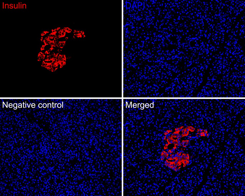Immunofluorescence analysis of paraffin-embedded human pancreas tissue labeling Insulin with Rabbit anti-Insulin antibody (ET1601-12) at 1/500 dilution.<br />
<br />
The section was pre-treated using heat mediated antigen retrieval with Tris-EDTA buffer (pH 9.0) for 20 minutes. The tissues were blocked in 10% negative goat serum for 1 hour at room temperature, washed with PBS, and then probed with the primary antibody (ET1601-12, red) at 1/500 dilution overnight at 4 ℃, washed with PBS.<br />
<br />
Goat Anti-Rabbit IgG H&L (Alexa Fluor® 594) was used as the secondary antibody at 1/500 dilution. Nuclei were counterstained with DAPI (blue).