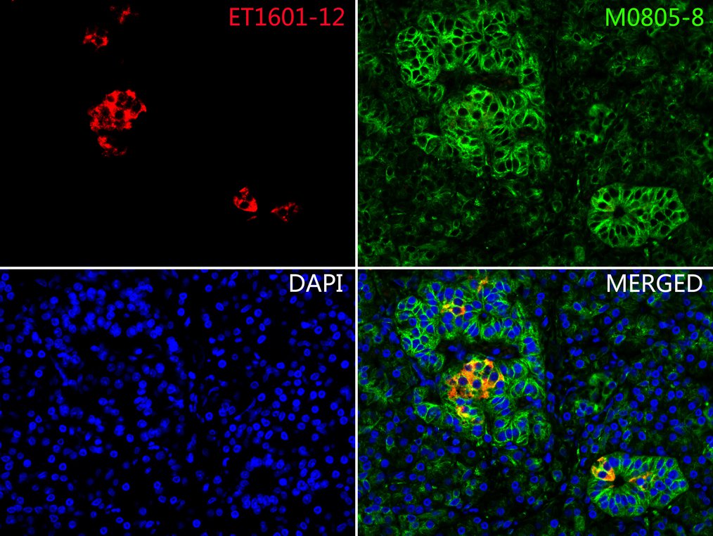 Immunofluorescence analysis of paraffin-embedded human pancreas tissue labeling Insulin (ET1601-12) and beta III Tubulin (M0805-8).<br />
<br />
The section was pre-treated using heat mediated antigen retrieval with Tris-EDTA buffer (pH 9.0) for 20 minutes. The tissues were blocked in 10% negative goat serum for 1 hour at room temperature, washed with PBS. And then probed with the primary antibodies Insulin (ET1601-12, red) at 1/200 dilution and beta III Tubulin (M0805-8, green) at 1/200 dilution at +4℃ overnight, washed with PBS.<br />
<br />
Goat Anti-Mouse IgG H&L (iFluor™ 488, HA1125) and Goat Anti-Rabbit IgG H&L (iFluor™ 594, HA1122) were used as the secondary antibody at 1/1,000 dilution. Nuclei were counterstained with DAPI (blue).