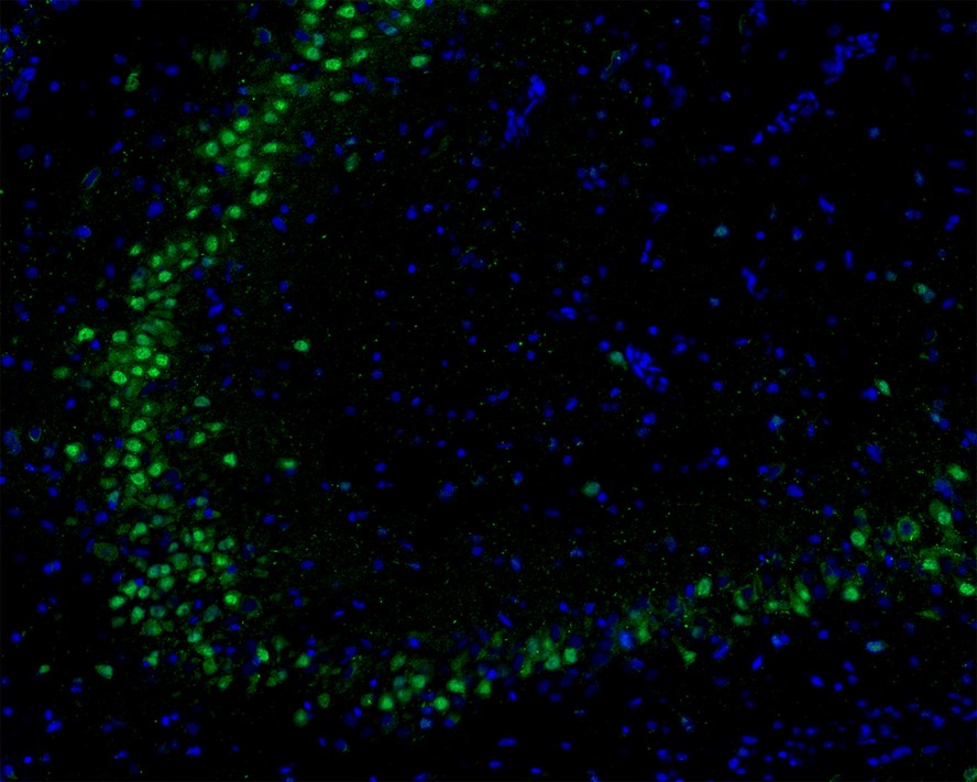 Flow cytometric analysis of AKT1 was done on Hela cells. The cells were fixed, permeabilized and stained with the primary antibody (ET1609-47, 1/50) (blue). After incubation of the primary antibody at room temperature for an hour, the cells were stained with a Alexa Fluor 488-conjugated Goat anti-Rabbit IgG Secondary antibody at 1/1000 dilution for 30 minutes.Unlabelled sample was used as a control (cells without incubation with primary antibody; red).
