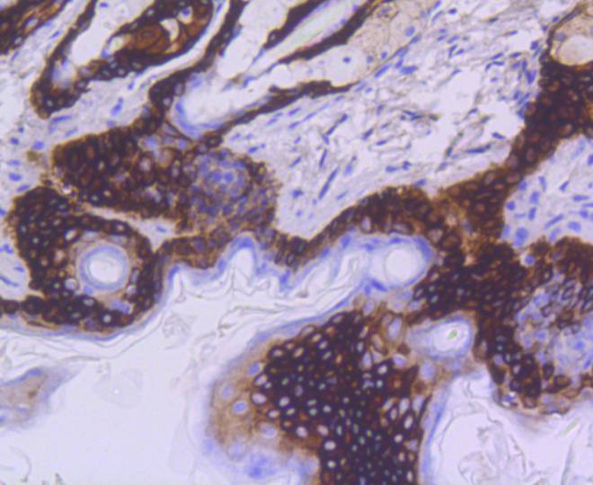 Immunohistochemical analysis of paraffin-embedded mouse skin tissue using anti-Cytokeratin 15 antibody. The section was pre-treated using heat mediated antigen retrieval with Tris-EDTA buffer (pH 8.0-8.4) for 20 minutes.The tissues were blocked in 5% BSA for 30 minutes at room temperature, washed with ddH2O and PBS, and then probed with the primary antibody (ET1609-54, 1/50) for 30 minutes at room temperature. The detection was performed using an HRP conjugated compact polymer system. DAB was used as the chromogen. Tissues were counterstained with hematoxylin and mounted with DPX.