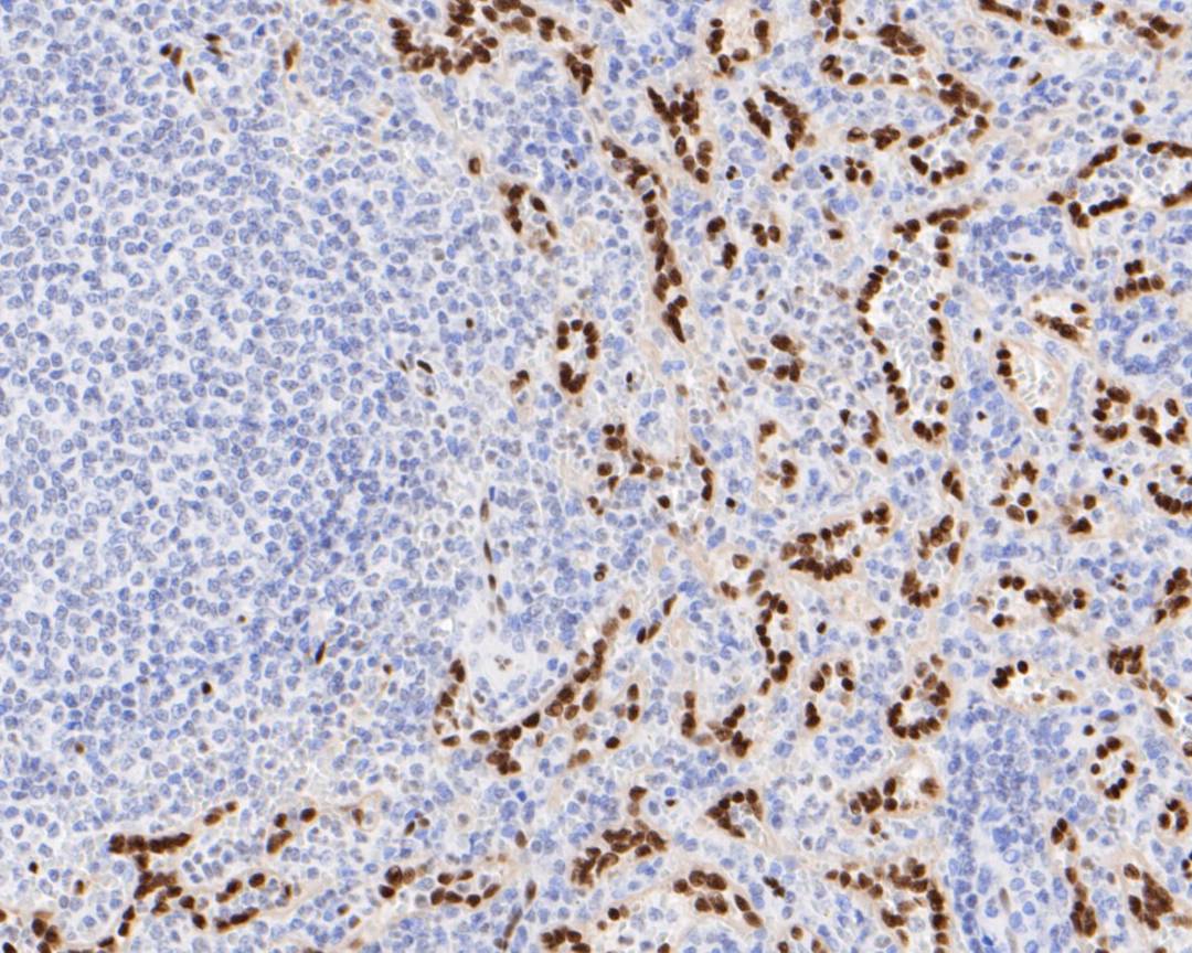 Immunohistochemical analysis of paraffin-embedded human kidney tissue with Rabbit anti-ERG antibody (ET1604-21) at 1/500 dilution.<br />
<br />
The section was pre-treated using heat mediated antigen retrieval with sodium citrate buffer (pH 6.0) for 2 minutes. The tissues were blocked in 1% BSA for 20 minutes at room temperature, washed with ddH2O and PBS, and then probed with the primary antibody (ET1604-21) at 1/500 dilution for 1 hour at room temperature. The detection was performed using an HRP conjugated compact polymer system. DAB was used as the chromogen. Tissues were counterstained with hematoxylin and mounted with DPX.