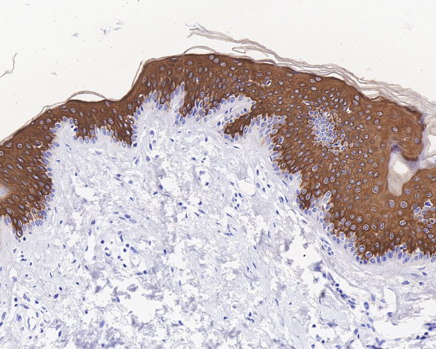 Immunohistochemical analysis of paraffin-embedded human skin tissue with Rabbit anti-Cytokeratin 10 antibody (ET1609-75) at 1/400 dilution.<br />
<br />
The section was pre-treated using heat mediated antigen retrieval with Tris-EDTA buffer (pH 9.0) for 20 minutes. The tissues were blocked in 1% BSA for 20 minutes at room temperature, washed with ddH2O and PBS, and then probed with the primary antibody (ET1609-75) at 1/400 dilution for 1 hour at room temperature. The detection was performed using an HRP conjugated compact polymer system. DAB was used as the chromogen. Tissues were counterstained with hematoxylin and mounted with DPX.