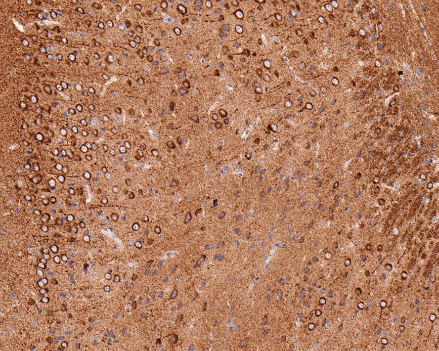 Immunohistochemical analysis of paraffin-embedded mouse brain tissue with Rabbit anti-VEGF antibody (ET1604-28) at 1/400 dilution.<br />
<br />
The section was pre-treated using heat mediated antigen retrieval with Tris-EDTA buffer (pH 9.0) for 20 minutes. The tissues were blocked in 1% BSA for 20 minutes at room temperature, washed with ddH2O and PBS, and then probed with the primary antibody (ET1604-28) at 1/400 dilution for 1 hour at room temperature. The detection was performed using an HRP conjugated compact polymer system. DAB was used as the chromogen. Tissues were counterstained with hematoxylin and mounted with DPX.