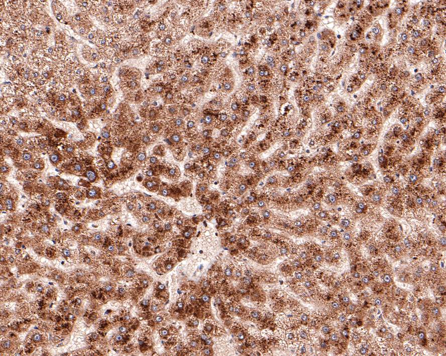 Immunohistochemical analysis of paraffin-embedded human liver tissue with Rabbit anti-BCL2A1 antibody (ET1610-20) at 1/400 dilution.<br />
<br />
The section was pre-treated using heat mediated antigen retrieval with Tris-EDTA buffer (pH 9.0) for 20 minutes. The tissues were blocked in 1% BSA for 20 minutes at room temperature, washed with ddH2O and PBS, and then probed with the primary antibody (ET1610-20) at 1/400 dilution for 1 hour at room temperature. The detection was performed using an HRP conjugated compact polymer system. DAB was used as the chromogen. Tissues were counterstained with hematoxylin and mounted with DPX.