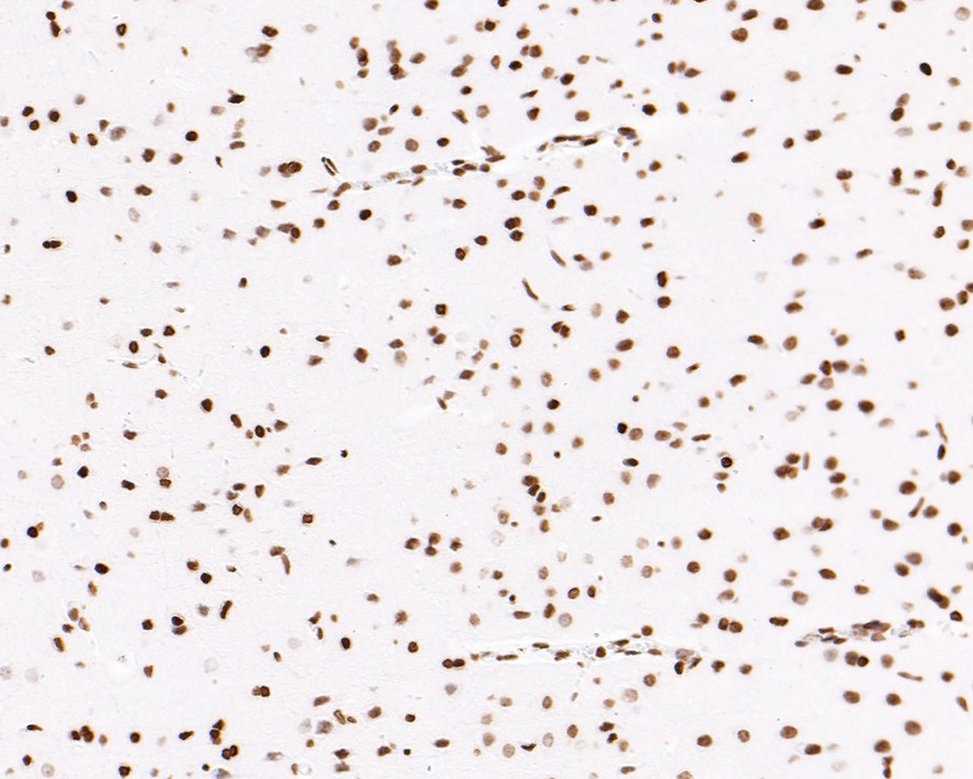 Immunohistochemical analysis of paraffin-embedded rat hippocampus tissue with Rabbit anti-Histone H3 (acetyl K14) antibody (ET1706-28) at 1/500 dilution.<br />
<br />
The section was pre-treated using heat mediated antigen retrieval with Tris-EDTA buffer (pH 9.0) for 20 minutes. The tissues were blocked in 1% BSA for 20 minutes at room temperature, washed with ddH2O and PBS, and then probed with the primary antibody (ET1706-28) at 1/500 dilution for 1 hour at room temperature. The detection was performed using an HRP conjugated compact polymer system. DAB was used as the chromogen. Tissues were counterstained with hematoxylin and mounted with DPX.