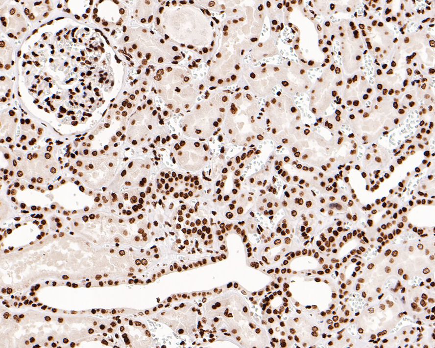 Immunohistochemical analysis of paraffin-embedded human colon tissue with Rabbit anti-Histone H3 (acetyl K14) antibody (ET1706-28) at 1/500 dilution.<br />
<br />
The section was pre-treated using heat mediated antigen retrieval with Tris-EDTA buffer (pH 9.0) for 20 minutes. The tissues were blocked in 1% BSA for 20 minutes at room temperature, washed with ddH2O and PBS, and then probed with the primary antibody (ET1706-28) at 1/500 dilution for 1 hour at room temperature. The detection was performed using an HRP conjugated compact polymer system. DAB was used as the chromogen. Tissues were counterstained with hematoxylin and mounted with DPX.