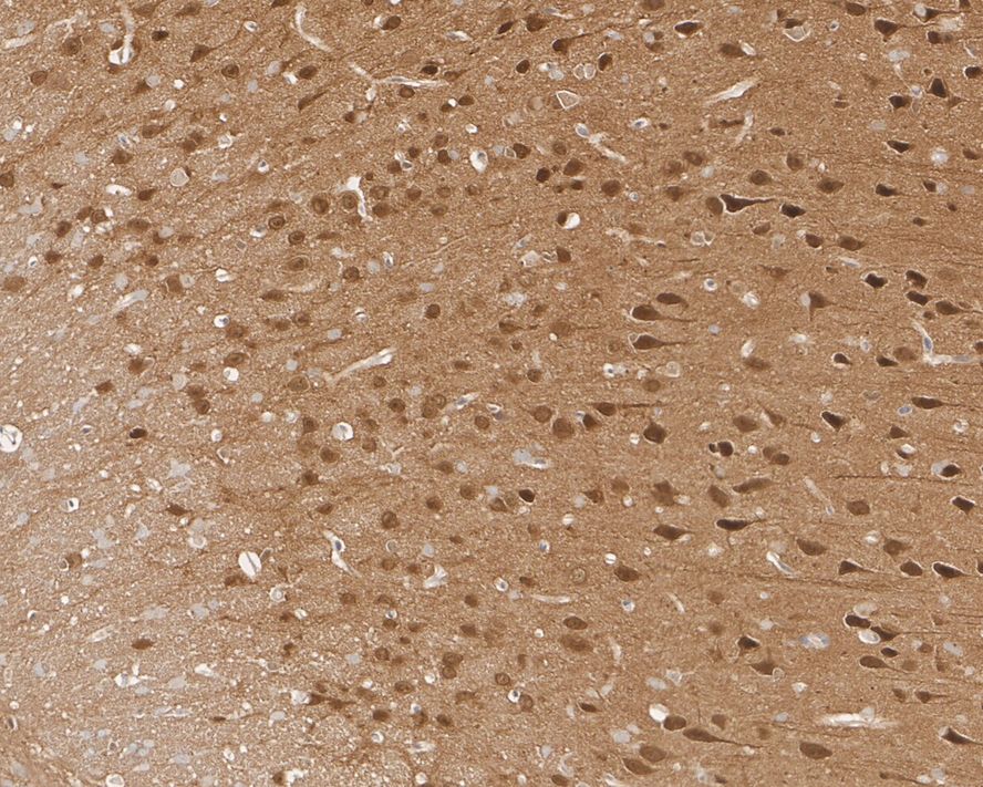 Immunohistochemical analysis of paraffin-embedded rat brain tissue with Rabbit anti-JNK1+JNK2+JNK3 antibody (ET1601-28) at 1/1,000 dilution.<br />
<br />
The section was pre-treated using heat mediated antigen retrieval with sodium citrate buffer (pH 6.0) for 2 minutes. The tissues were blocked in 1% BSA for 20 minutes at room temperature, washed with ddH2O and PBS, and then probed with the primary antibody (ET1601-28) at 1/1,000 dilution for 1 hour at room temperature. The detection was performed using an HRP conjugated compact polymer system. DAB was used as the chromogen. Tissues were counterstained with hematoxylin and mounted with DPX.