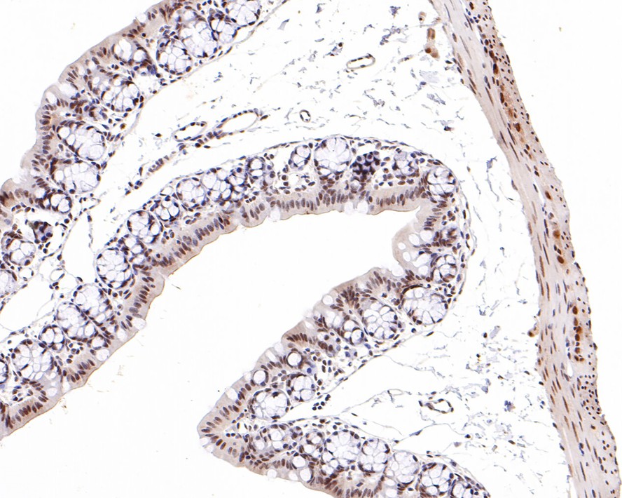 Immunohistochemical analysis of paraffin-embedded mouse large intestine tissue with Rabbit anti-SNF5 antibody (ET7107-84) at 1/500 dilution.<br />
<br />
The section was pre-treated using heat mediated antigen retrieval with sodium citrate buffer (pH 6.0) for 2 minutes. The tissues were blocked in 1% BSA for 20 minutes at room temperature, washed with ddH2O and PBS, and then probed with the primary antibody (ET7107-84) at 1/500 dilution for 1 hour at room temperature. The detection was performed using an HRP conjugated compact polymer system. DAB was used as the chromogen. Tissues were counterstained with hematoxylin and mounted with DPX.