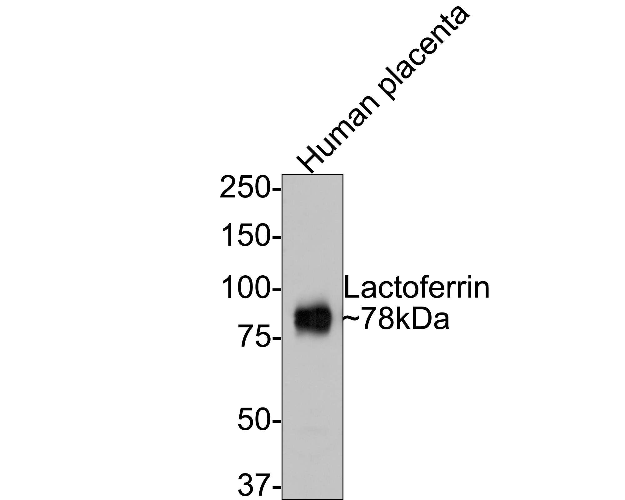 Western blot analysis of Lactoferrin on human placenta tissue lysates with Rabbit anti-Lactoferrin antibody (ET7109-95) at 1/500 dilution.<br />
<br />
Lysates/proteins at 20 µg/Lane.<br />
<br />
Predicted band size: 78 kDa<br />
Observed band size: 78 kDa<br />
<br />
Exposure time: 2 minutes;<br />
<br />
8% SDS-PAGE gel.<br />
<br />
Proteins were transferred to a PVDF membrane and blocked with 5% NFDM/TBST for 1 hour at room temperature. The primary antibody (ET7109-95) at 1/500 dilution was used in 5% NFDM/TBST at room temperature for 2 hours. Goat Anti-Rabbit IgG - HRP Secondary Antibody (HA1001) at 1:300,000 dilution was used for 1 hour at room temperature.