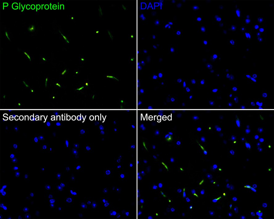 Immunofluorescence analysis of paraffin-embedded rat brain tissue labeling P Glycoprotein with Rabbit anti-P Glycoprotein antibody (ET1611-30) at 1/50 dilution.<br />
<br />
The section was pre-treated using heat mediated antigen retrieval with Tris-EDTA buffer (pH 9.0) for 20 minutes. The tissues were blocked in 10% negative goat serum for 1 hour at room temperature, washed with PBS, and then probed with the primary antibody (ET1611-30, green) at 1/50 dilution overnight at 4 ℃, washed with PBS.<br />
<br />
Goat Anti-Rabbit IgG H&L (iFluor™ 488, HA1121) was used as the secondary antibody at 1/1,000 dilution. Nuclei were counterstained with DAPI (blue).