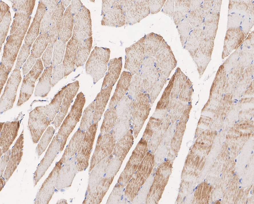 Immunohistochemical analysis of paraffin-embedded rat skeletal muscle tissue with Rabbit anti-Plectin antibody (ET1607-80) at 1/1,000 dilution.<br />
<br />
The section was pre-treated using heat mediated antigen retrieval with Tris-EDTA buffer (pH 9.0) for 20 minutes. The tissues were blocked in 1% BSA for 20 minutes at room temperature, washed with ddH2O and PBS, and then probed with the primary antibody (ET1607-80) at 1/1,000 dilution for 1 hour at room temperature. The detection was performed using an HRP conjugated compact polymer system. DAB was used as the chromogen. Tissues were counterstained with hematoxylin and mounted with DPX.