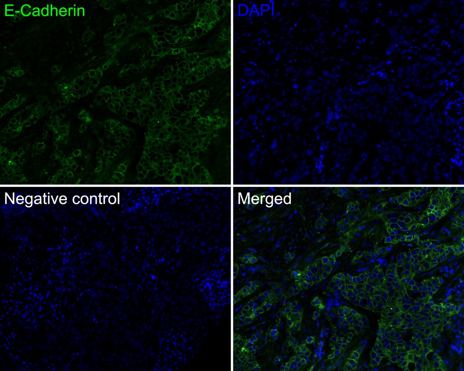 Immunofluorescence analysis of paraffin-embedded human colon tissue labeling E-Cadherin with Rabbit anti-E-Cadherin antibody (ET1607-75) at 1/50 dilution.<br />
<br />
The section was pre-treated using heat mediated antigen retrieval with Tris-EDTA buffer (pH 9.0) for 20 minutes. The tissues were blocked in 10% negative goat serum for 1 hour at room temperature, washed with PBS, and then probed with the primary antibody (ET1607-75, green) at 1/50 dilution overnight at 4 ℃, washed with PBS.<br />
<br />
Goat Anti-Rabbit IgG H&L (iFluor™ 488, HA1121) was used as the secondary antibody at 1/1,000 dilution. Nuclei were counterstained with 33258 (blue).