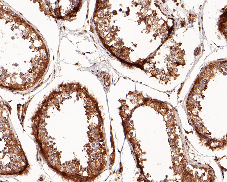 Immunohistochemical analysis of paraffin-embedded human testis tissue with Rabbit anti-Phospho-Raf1 (S259) antibody (ET1612-87) at 1/500 dilution.<br />
<br />
The section was pre-treated using heat mediated antigen retrieval with sodium citrate buffer (pH 6.0) for 2 minutes. The tissues were blocked in 1% BSA for 20 minutes at room temperature, washed with ddH2O and PBS, and then probed with the primary antibody (ET1612-87) at 1/500 dilution for 1 hour at room temperature. The detection was performed using an HRP conjugated compact polymer system. DAB was used as the chromogen. Tissues were counterstained with hematoxylin and mounted with DPX.