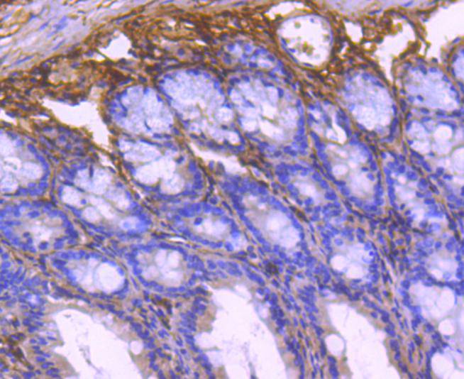 Immunohistochemical analysis of paraffin-embedded human colon tissue with Rabbit anti-Collagen VI antibody (ET1612-91) at 1/400 dilution.<br />
<br />
The section was pre-treated using heat mediated antigen retrieval with Tris-EDTA buffer (pH 9.0) for 20 minutes. The tissues were blocked in 1% BSA for 20 minutes at room temperature, washed with ddH2O and PBS, and then probed with the primary antibody (ET1612-91) at 1/400 dilution for 1 hour at room temperature. The detection was performed using an HRP conjugated compact polymer system. DAB was used as the chromogen. Tissues were counterstained with hematoxylin and mounted with DPX.