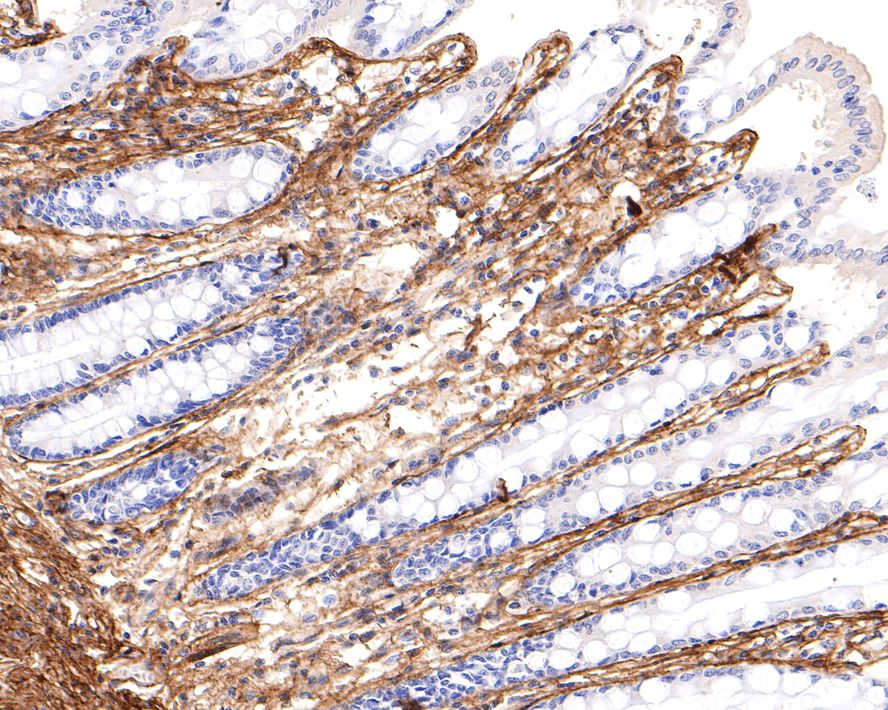 Immunohistochemical analysis of paraffin-embedded human skin tissue with Rabbit anti-Collagen VI antibody (ET1612-91) at 1/400 dilution.<br />
<br />
The section was pre-treated using heat mediated antigen retrieval with Tris-EDTA buffer (pH 9.0) for 20 minutes. The tissues were blocked in 1% BSA for 20 minutes at room temperature, washed with ddH2O and PBS, and then probed with the primary antibody (ET1612-91) at 1/400 dilution for 1 hour at room temperature. The detection was performed using an HRP conjugated compact polymer system. DAB was used as the chromogen. Tissues were counterstained with hematoxylin and mounted with DPX.