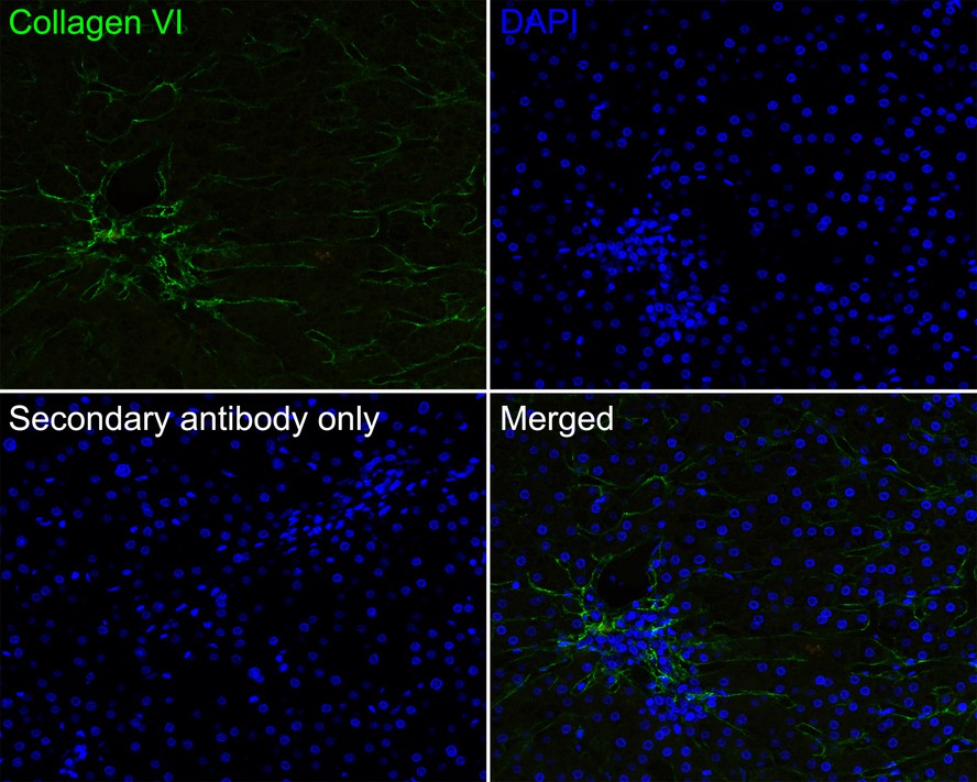 Immunofluorescence analysis of paraffin-embedded mouse colon tissue labeling Collagen VI with Rabbit anti-Collagen VI antibody (ET1612-91) at 1/100 dilution.<br />
<br />
The section was pre-treated using heat mediated antigen retrieval with Tris-EDTA buffer (pH 9.0) for 20 minutes. The tissues were blocked in 10% negative goat serum for 1 hour at room temperature, washed with PBS, and then probed with the primary antibody (ET1612-91, green) at 1/100 dilution overnight at 4 ℃, washed with PBS.<br />
<br />
Goat Anti-Rabbit IgG H&L (iFluor™ 488, HA1121) was used as the secondary antibody at 1/1,000 dilution. Nuclei were counterstained with DAPI (blue).