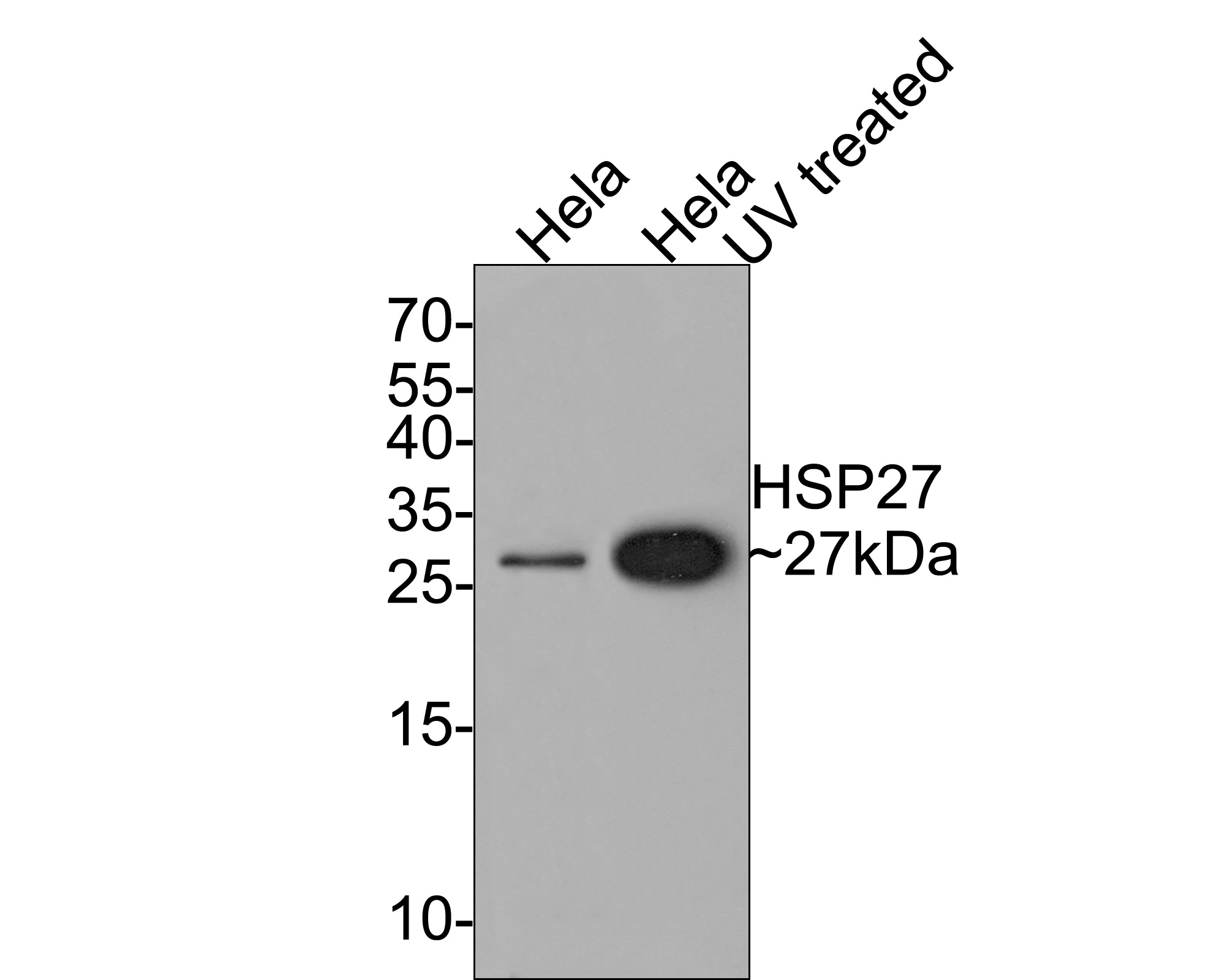 Western blot analysis of Phospho-Hsp27(S78) on different lysates with Rabbit anti-Phospho-Hsp27(S78) antibody (ET1701-19) at 1/500 dilution.<br />
<br />
Lane 1: Hela cell lysate<br />
Lane 2: Hela cell lysate treated with UV for 2 hours<br />
<br />
Lysates/proteins at 10 µg/Lane.<br />
<br />
Predicted band size: 23 kDa<br />
Observed band size: 27 kDa<br />
<br />
Exposure time: 2 minutes;<br />
<br />
15% SDS-PAGE gel.<br />
<br />
Proteins were transferred to a PVDF membrane and blocked with 5% NFDM/TBST for 1 hour at room temperature. The primary antibody (ET1701-19) at 1/500 dilution was used in 5% NFDM/TBST at room temperature for 2 hours. Goat Anti-Rabbit IgG - HRP Secondary Antibody (HA1001) at 1:300,000 dilution was used for 1 hour at room temperature.