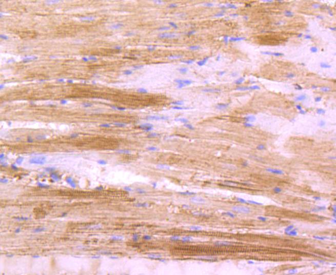 Immunohistochemical analysis of paraffin-embedded mouse smooth muscle tissue using anti-Actin antibody. The section was pre-treated using heat mediated antigen retrieval with Tris-EDTA buffer (pH 8.0-8.4) for 20 minutes.The tissues were blocked in 5% BSA for 30 minutes at room temperature, washed with ddH2O and PBS, and then probed with the primary antibody (ET1701-80, 1/50) for 30 minutes at room temperature. The detection was performed using an HRP conjugated compact polymer system. DAB was used as the chromogen. Tissues were counterstained with hematoxylin and mounted with DPX.