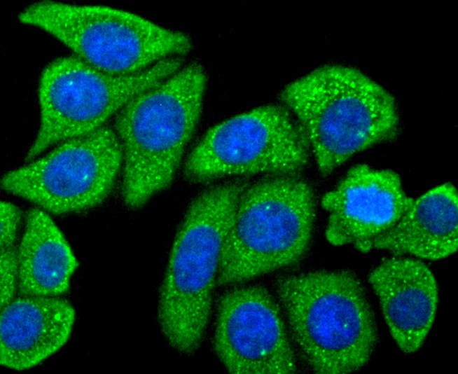 ICC staining of Mannose Receptor(CD206) in HepG2 cells (green). Formalin fixed cells were permeabilized with 0.1% Triton X-100 in TBS for 10 minutes at room temperature and blocked with 1% Blocker BSA for 15 minutes at room temperature. Cells were probed with the primary antibody (ET1702-04, 1/50) for 1 hour at room temperature, washed with PBS. Alexa Fluor®488 Goat anti-Rabbit IgG was used as the secondary antibody at 1/1,000 dilution. The nuclear counter stain is DAPI (blue).