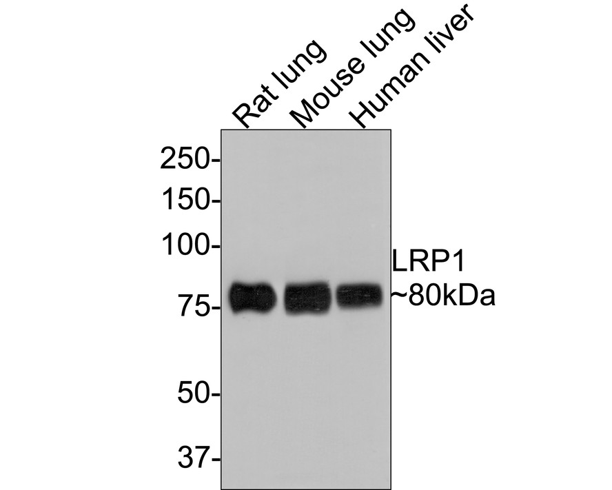 Western blot analysis of LRP1 on different lysates with Rabbit anti-LRP1 antibody (ET1601-1) at 1/5,000 dilution.<br />
<br />
Lane 1: Rat lung tissue lysate<br />
Lane 2: Mouse lung tissue lysate<br />
Lane 3: Human liver tissue lysate<br />
<br />
Lysates/proteins at 20 µg/Lane.<br />
<br />
Predicted band size: 505 kDa<br />
Observed band size: 80 kDa<br />
<br />
Exposure time: 1 minute;<br />
<br />
8% SDS-PAGE gel.<br />
<br />
Proteins were transferred to a PVDF membrane and blocked with 5% NFDM/TBST for 1 hour at room temperature. The primary antibody (ET1601-1) at 1/5,000 dilution was used in 5% NFDM/TBST at room temperature for 2 hours. Goat Anti-Rabbit IgG - HRP Secondary Antibody (HA1001) at 1:300,000 dilution was used for 1 hour at room temperature.