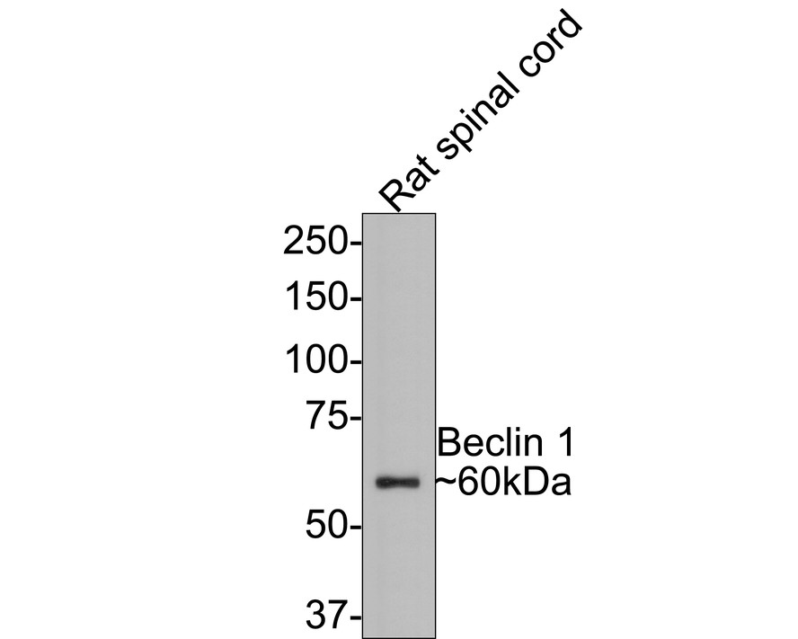 Western blot analysis of Beclin 1 on Rat spinal cord tissue lysates with Rabbit anti-Beclin 1 antibody (R1509-1) at 1/500 dilution.<br />
<br />
Lysates/proteins at 20 µg/Lane.<br />
<br />
Predicted band size: 52 kDa<br />
Observed band size: 60 kDa<br />
<br />
Exposure time: 2 minutes;<br />
<br />
8% SDS-PAGE gel.<br />
<br />
Proteins were transferred to a PVDF membrane and blocked with 5% NFDM/TBST for 1 hour at room temperature. The primary antibody (R1509-1) at 1/500 dilution was used in 5% NFDM/TBST at room temperature for 2 hours. Goat Anti-Rabbit IgG - HRP Secondary Antibody (HA1001) at 1:300,000 dilution was used for 1 hour at room temperature.