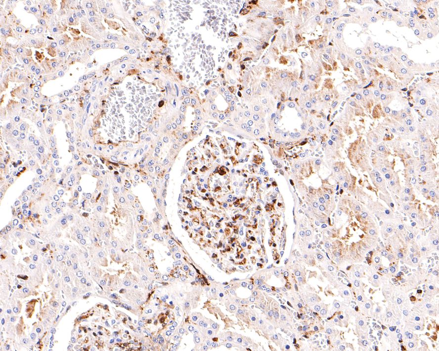 Immunohistochemical analysis of paraffin-embedded human kidney tissue with Rabbit anti-Vitronectin antibody (ET1609-39) at 1/400 dilution.<br />
<br />
The section was pre-treated using heat mediated antigen retrieval with Tris-EDTA buffer (pH 9.0) for 20 minutes. The tissues were blocked in 1% BSA for 20 minutes at room temperature, washed with ddH2O and PBS, and then probed with the primary antibody (ET1609-39) at 1/400 dilution for 1 hour at room temperature. The detection was performed using an HRP conjugated compact polymer system. DAB was used as the chromogen. Tissues were counterstained with hematoxylin and mounted with DPX.