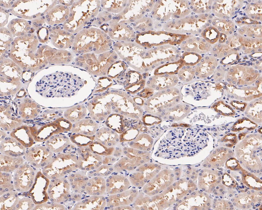 Immunohistochemical analysis of paraffin-embedded human kidney tissue with Rabbit anti-Phospho-PP2A(Y307) antibody (ET1609-40) at 1/200 dilution.<br />
<br />
The section was pre-treated using heat mediated antigen retrieval with Tris-EDTA buffer (pH 9.0) for 20 minutes. The tissues were blocked in 1% BSA for 20 minutes at room temperature, washed with ddH2O and PBS, and then probed with the primary antibody (ET1609-40) at 1/200 dilution for 1 hour at room temperature. The detection was performed using an HRP conjugated compact polymer system. DAB was used as the chromogen. Tissues were counterstained with hematoxylin and mounted with DPX.