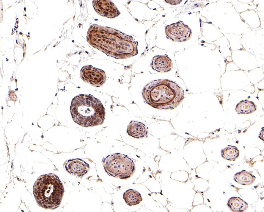 Immunohistochemical analysis of paraffin-embedded mouse skin tissue with Rabbit anti-Phospho-Smad3(S423/S425) antibody (ET1609-41) at 1/500 dilution.<br />
<br />
The section was pre-treated using heat mediated antigen retrieval with sodium citrate buffer (pH 6.0) for 20 minutes. The tissues were blocked in 1% BSA for 20 minutes at room temperature, washed with ddH2O and PBS, and then probed with the primary antibody (ET1609-41) at 1/500 dilution for 1 hour at room temperature. The detection was performed using an HRP conjugated compact polymer system. DAB was used as the chromogen. Tissues were counterstained with hematoxylin and mounted with DPX.