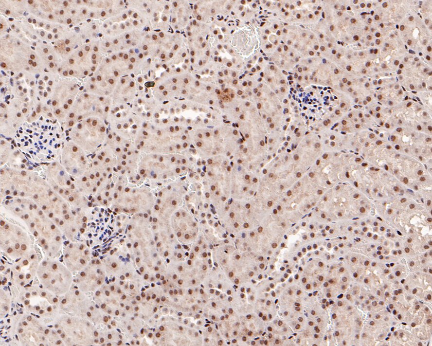 Immunohistochemical analysis of paraffin-embedded mouse kidney tissue with Rabbit anti-Phospho-Smad3(S423/S425) antibody (ET1609-41) at 1/500 dilution.<br />
<br />
The section was pre-treated using heat mediated antigen retrieval with sodium citrate buffer (pH 6.0) for 20 minutes. The tissues were blocked in 1% BSA for 20 minutes at room temperature, washed with ddH2O and PBS, and then probed with the primary antibody (ET1609-41) at 1/500 dilution for 1 hour at room temperature. The detection was performed using an HRP conjugated compact polymer system. DAB was used as the chromogen. Tissues were counterstained with hematoxylin and mounted with DPX.