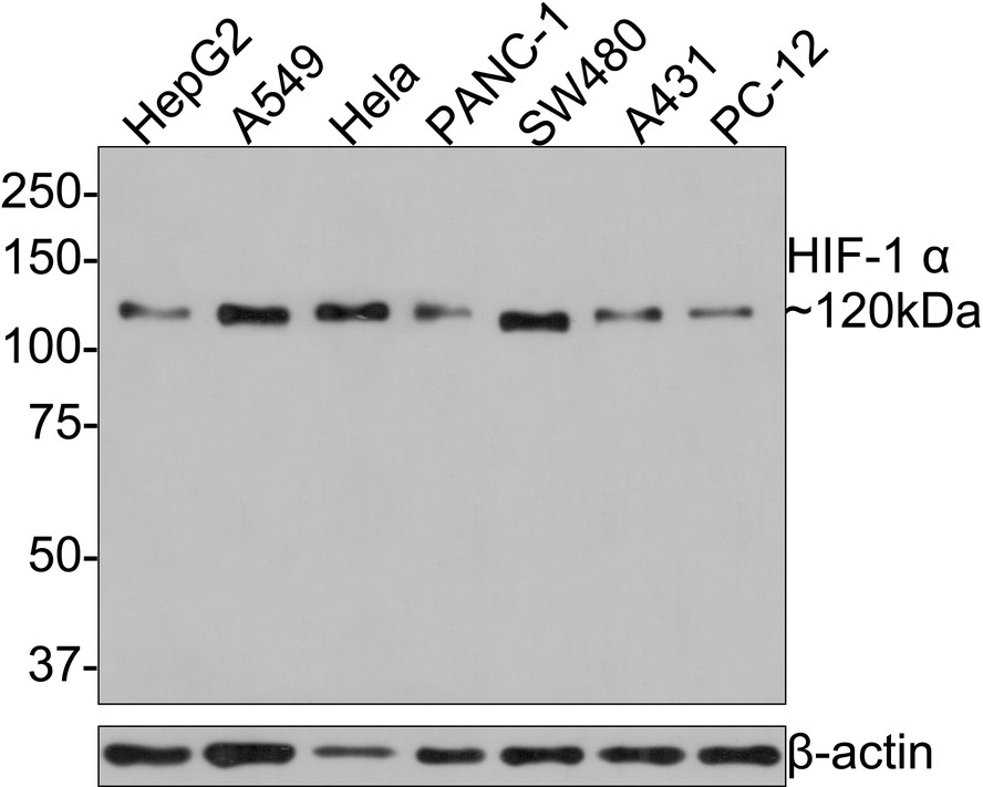Western blot analysis of HIF-1 alpha on different lysates with Rabbit anti-HIF-1 alpha antibody (R1510-5) at 1/500 dilution.<br />
<br />
Lane 1: HepG2 cell lysate<br />
Lane 2: A549 cell lysate<br />
Lane 3: Hela cell lysate<br />
Lane 4: PANC-1 cell lysate<br />
Lane 5: SW480 cell lysate<br />
Lane 6: A431 cell lysate<br />
Lane 7: PC-12 cell lysate<br />
<br />
Lysates/proteins at 10 µg/Lane.<br />
<br />
Predicted band size: 93 kDa<br />
Observed band size: 120 kDa<br />
<br />
Exposure time: 1 minute;<br />
<br />
8% SDS-PAGE gel.<br />
<br />
Proteins were transferred to a PVDF membrane and blocked with 5% NFDM/TBST for 1 hour at room temperature. The primary antibody (R1510-5) at 1/500 dilution was used in 5% NFDM/TBST at room temperature for 2 hours. Goat Anti-Rabbit IgG - HRP Secondary Antibody (HA1001) at 1:300,000 dilution was used for 1 hour at room temperature.