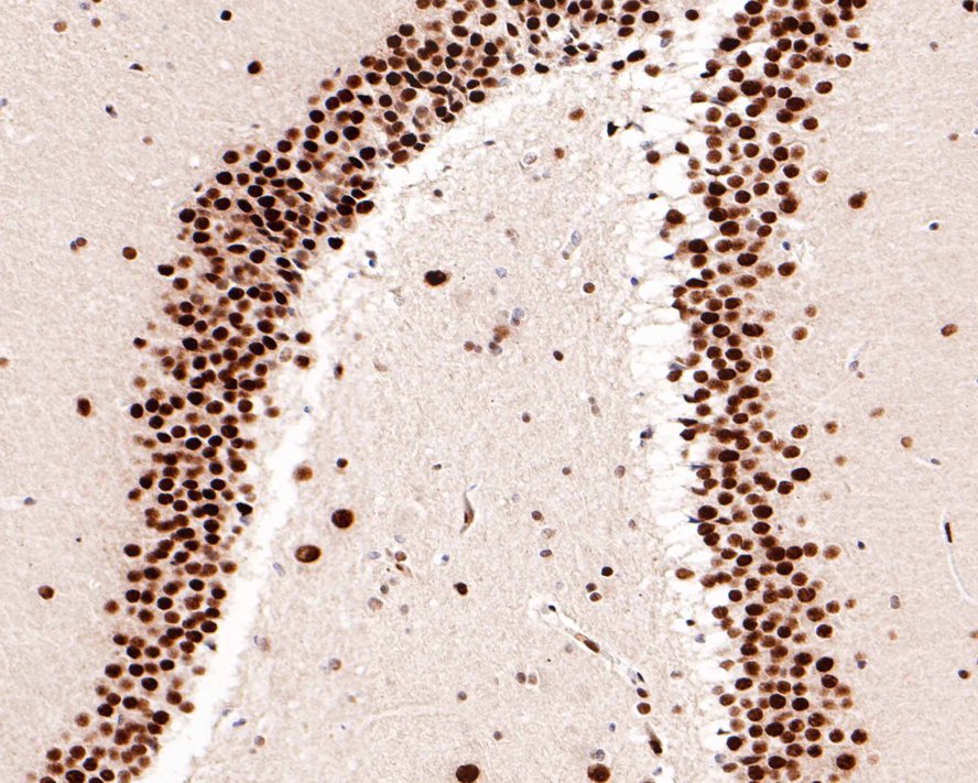 Immunohistochemical analysis of paraffin-embedded rat hippocampus tissue with Rabbit anti-Phospho-STAT3 (S727) antibody (ET1607-39) at 1:500 dilution.<br />
<br />
The section was pre-treated using heat mediated antigen retrieval with Tris-EDTA buffer (pH 9.0) for 20 minutes. The tissues were blocked in 1% BSA for 20 minutes at room temperature, washed with ddH2O and PBS, and then probed with the primary antibody (ET1607-39) at 1:500 dilution for 1 hour at room temperature. The detection was performed using an HRP conjugated compact polymer system. DAB was used as the chromogen. Tissues were counterstained with hematoxylin and mounted with DPX.