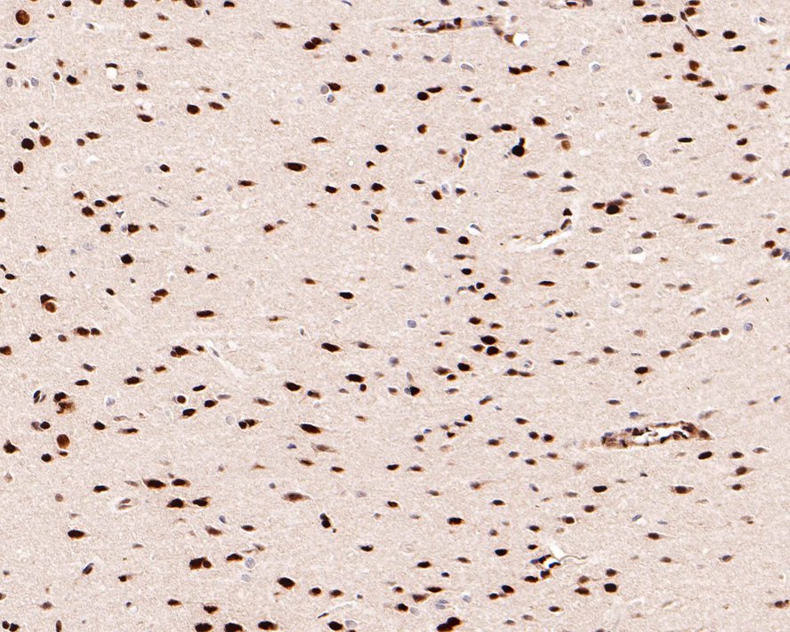 Immunohistochemical analysis of paraffin-embedded rat brain tissue with Rabbit anti-Phospho-STAT3 (S727) antibody (ET1607-39) at 1:500 dilution.<br />
<br />
The section was pre-treated using heat mediated antigen retrieval with Tris-EDTA buffer (pH 9.0) for 20 minutes. The tissues were blocked in 1% BSA for 20 minutes at room temperature, washed with ddH2O and PBS, and then probed with the primary antibody (ET1607-39) at 1:500 dilution for 1 hour at room temperature. The detection was performed using an HRP conjugated compact polymer system. DAB was used as the chromogen. Tissues were counterstained with hematoxylin and mounted with DPX.