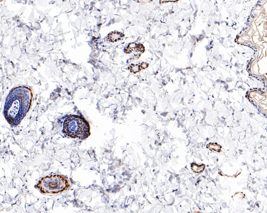 Immunohistochemical analysis of paraffin-embedded rat skin tissue with Rabbit anti-Vitamin D Receptor antibody (ET1704-09) at 1/800 dilution.<br />
<br />
The section was pre-treated using heat mediated antigen retrieval with sodium citrate buffer (pH 6.0) for 2 minutes. The tissues were blocked in 1% BSA for 20 minutes at room temperature, washed with ddH2O and PBS, and then probed with the primary antibody (ET1704-09) at 1/800 dilution for 1 hour at room temperature. The detection was performed using an HRP conjugated compact polymer system. DAB was used as the chromogen. Tissues were counterstained with hematoxylin and mounted with DPX.