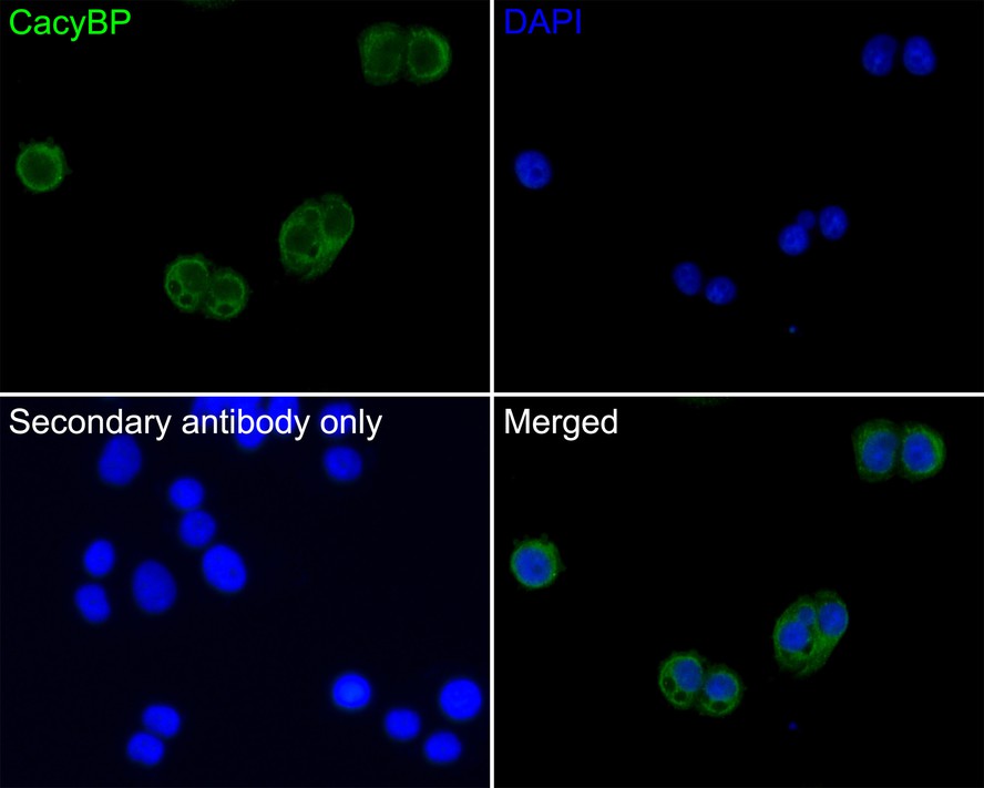 Immunocytochemistry analysis of MDA-MB-468 cells labeling CacyBP with Rabbit anti-CacyBP antibody (HA500484) at 1/200 dilution.<br />
<br />
Cells were fixed in 4% paraformaldehyde for 10 minutes at 37 ℃, permeabilized with 0.05% Triton X-100 in PBS for 20 minutes, and then blocked with 2% negative goat serum for 30 minutes at room temperature. Cells were then incubated with Rabbit anti-CacyBP antibody (HA500484) at 1/200 dilution in 2% negative goat serum overnight at 4 ℃. Goat Anti-Rabbit IgG H&L (iFluor™ 488, HA1121) was used as the secondary antibody at 1/1,000 dilution. PBS instead of the primary antibody was used as the secondary antibody only control. Nuclear DNA was labelled in blue with DAPI.