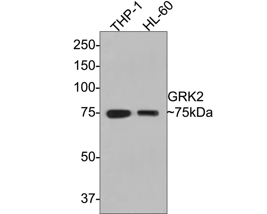 Western blot analysis of GRK2 on different lysates with Rabbit anti-GRK2 antibody (ET1609-72) at 1/500 dilution.<br />
<br />
Lane 1: THP-1 cell lysate<br />
Lane 2: HL-60 cell lysate<br />
<br />
Lysates/proteins at 10 µg/Lane.<br />
<br />
Predicted band size: 80 kDa<br />
Observed band size: 75 kDa<br />
<br />
Exposure time: 1 minute;<br />
<br />
8% SDS-PAGE gel.<br />
<br />
Proteins were transferred to a PVDF membrane and blocked with 5% NFDM/TBST for 1 hour at room temperature. The primary antibody (ET1609-72) at 1/500 dilution was used in 5% NFDM/TBST at room temperature for 2 hours. Goat Anti-Rabbit IgG - HRP Secondary Antibody (HA1001) at 1:300,000 dilution was used for 1 hour at room temperature.