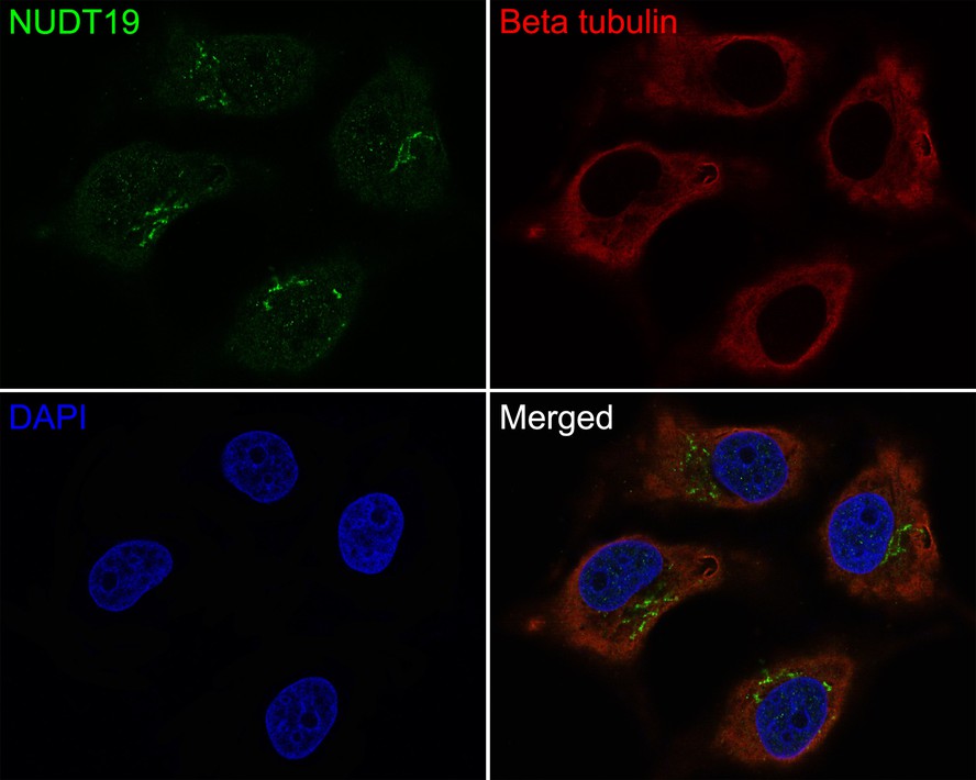 Immunocytochemistry analysis of Hela cells labeling NUDT19 with Rabbit anti-NUDT19 antibody (HA721101) at 1/50 dilution.<br />
<br />
Cells were fixed in 4% paraformaldehyde for 10 minutes at 37 ℃, permeabilized with 0.05% Triton X-100 in PBS for 20 minutes, and then blocked with 2% negative goat serum for 30 minutes at room temperature. Cells were then incubated with Rabbit anti-NUDT19 antibody (HA721101) at 1/50 dilution in 2% negative goat serum overnight at 4 ℃. Goat Anti-Rabbit IgG H&L (iFluor™ 488, HA1121) was used as the secondary antibody at 1/1,000 dilution. Nuclear DNA was labelled in blue with DAPI.<br />
<br />
Beta tubulin (M1305-2, red) was stained at 1/200 dilution overnight at +4℃. Goat Anti-Mouse IgG H&L (iFluor™ 647, HA1127) were used as the secondary antibody at 1/1,000 dilution.