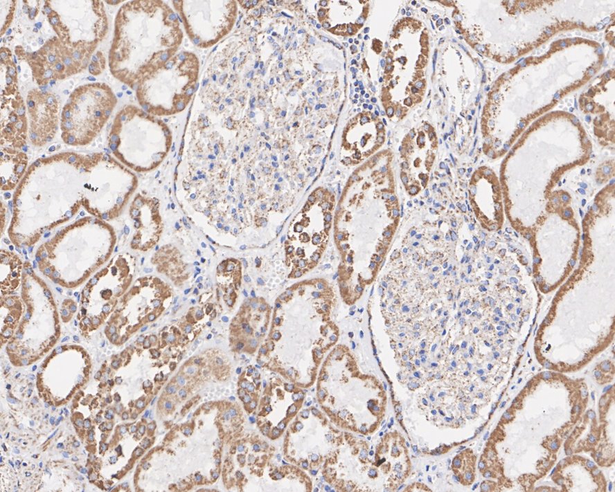 Immunohistochemical analysis of paraffin-embedded mouse kidney tissue using anti-VDAC1 antibody. The section was pre-treated using heat mediated antigen retrieval with Tris-EDTA buffer (pH 8.0-8.4) for 20 minutes.The tissues were blocked in 5% BSA for 30 minutes at room temperature, washed with ddH2O and PBS, and then probed with the primary antibody (ET1601-20, 1/200) for 30 minutes at room temperature. The detection was performed using an HRP conjugated compact polymer system. DAB was used as the chromogen. Tissues were counterstained with hematoxylin and mounted with DPX.