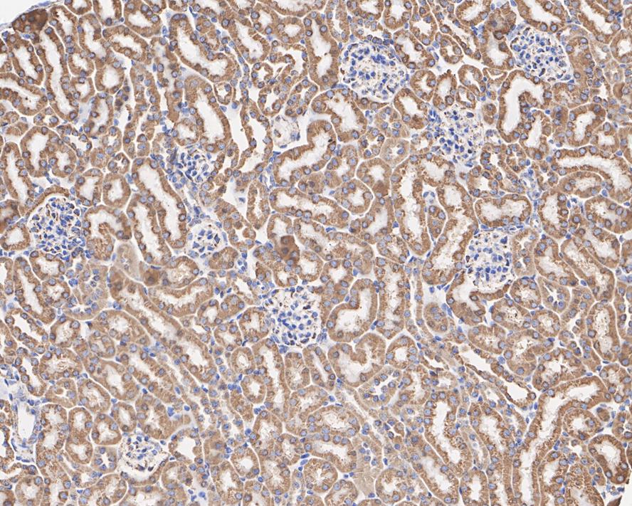 Immunocytochemistry analysis of HepG2 cells labeling VDAC1 with Rabbit anti-VDAC1 antibody (ET1601-20) at 1/50 dilution.<br />
<br />
Cells were fixed in 4% paraformaldehyde for 10 minutes at 37 ℃, permeabilized with 0.05% Triton X-100 in PBS for 20 minutes, and then blocked with 2% negative goat serum for 30 minutes at room temperature. Cells were then incubated with Rabbit anti-VDAC1 antibody (ET1601-20) at 1/50 dilution in 2% negative goat serum overnight at 4 ℃. Goat Anti-Rabbit IgG H&L (iFluor™ 488, HA1121) was used as the secondary antibody at 1/1,000 dilution. PBS instead of the primary antibody was used as the secondary antibody only control. Nuclear DNA was labelled in blue with DAPI.